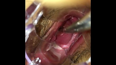 Japanese cervix playing