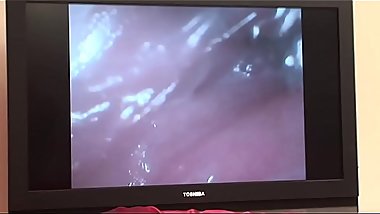 Asian babe with camera in ass and pussy in HD video